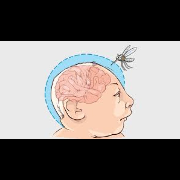 Relato da Identificação do vírus Zika e fetos com má formação