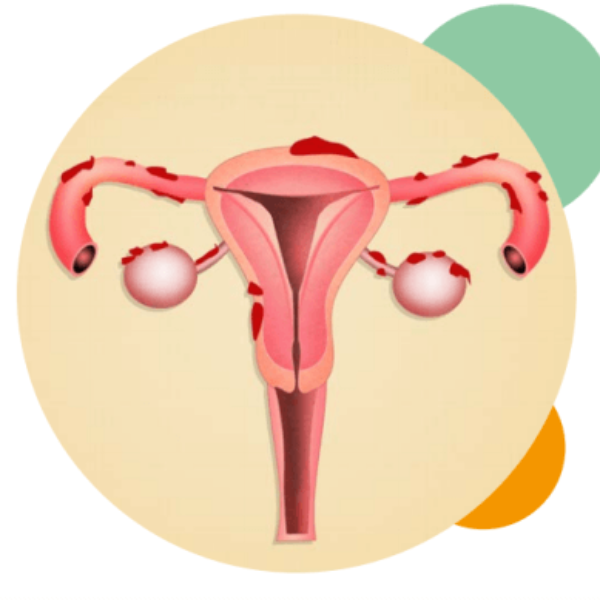 infertilidade feminina