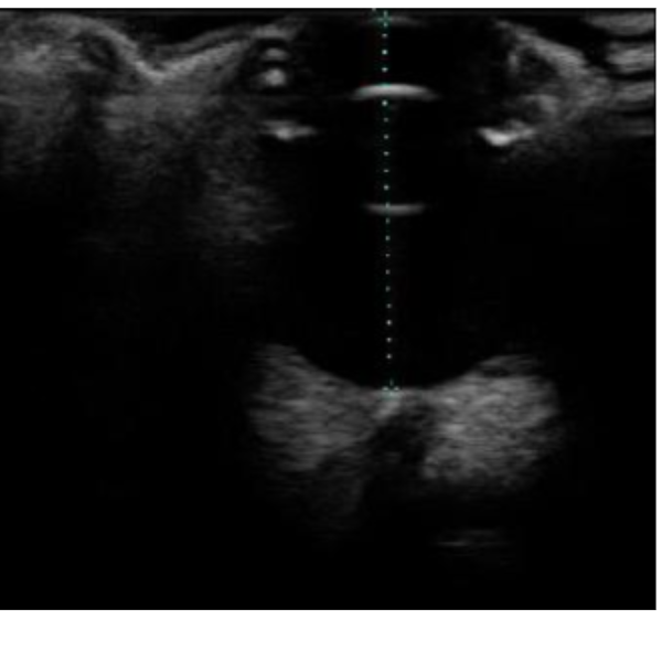 ULTRASSONOGRAFIA OCULAR EM PEQUENOS ANIMAIS