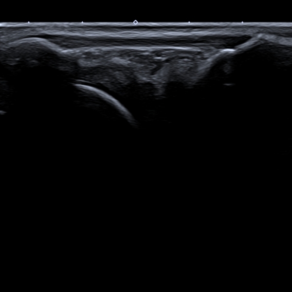 ULTRASSONOGRAFIA MUSCULOESQUELÉTICA: CASOS DE ROTINA