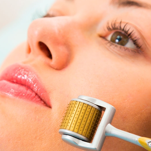 Microagulhamento: Uma Possibilidade de Atuação da Enfermagem na Estética com a Fisioterapeuta Me. Claudiane Ayres