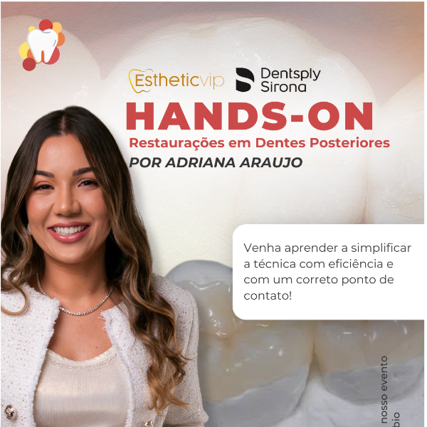 HANDS ON : Restaurações em Dentes Posteriores