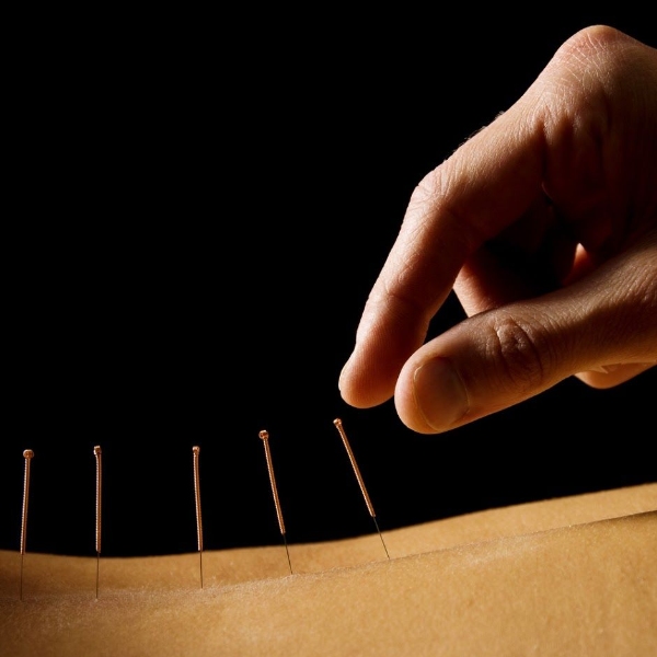 MINICURSO TÉCNICAS DE AGULHAMENTO EM ACUPUNTURA