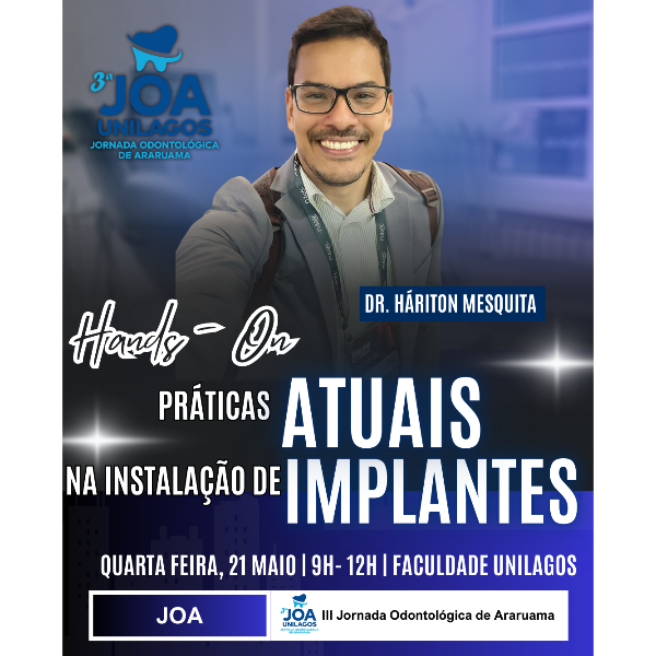 HANDS ON - Práticas atuais na instalação de implantes 