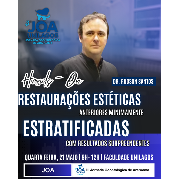 HANDS ON - Restaurações estéticas anteriores minimamente estratificadas com resultados surpreendentes.