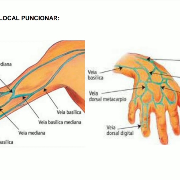 Anatomia e Punção do Acesso Venoso 