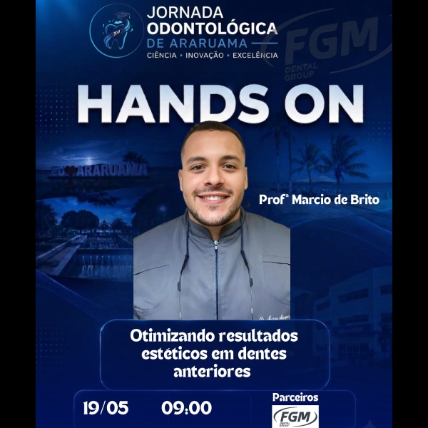 HANDS ON 5 - Otimizando resultados estéticos em dentes anteriores.
