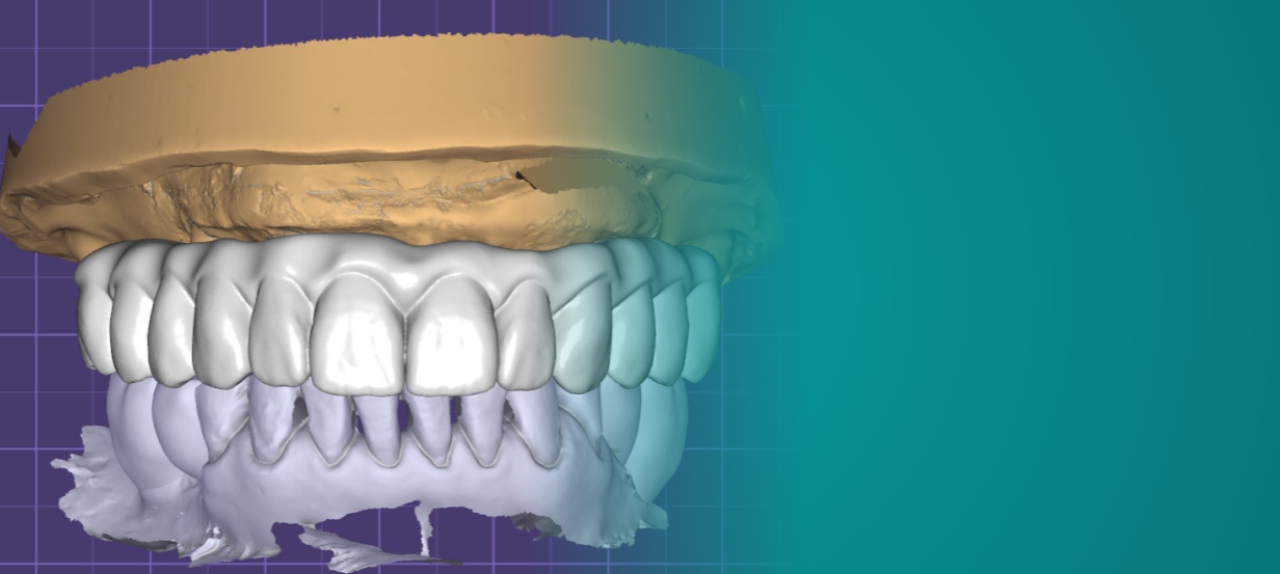 Curso Fluxo Digital em Prótese sobre Implante (PSI)