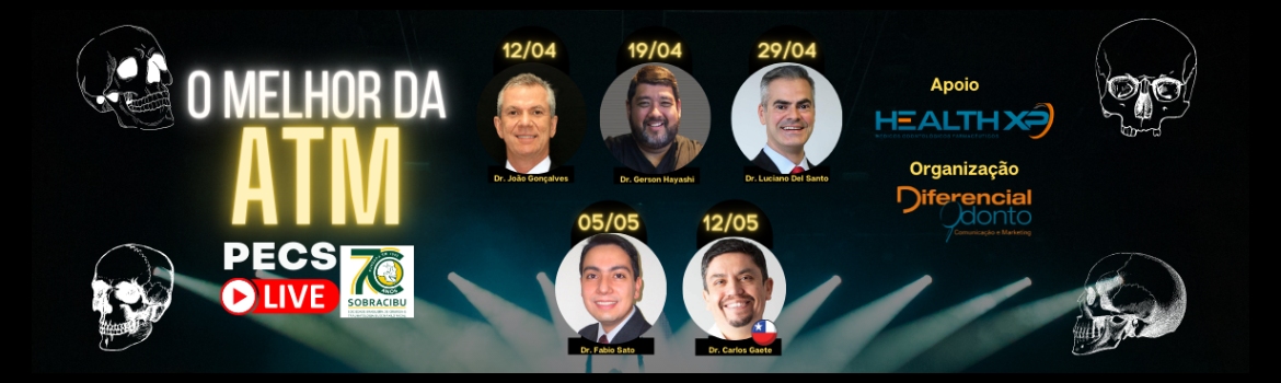 Evento