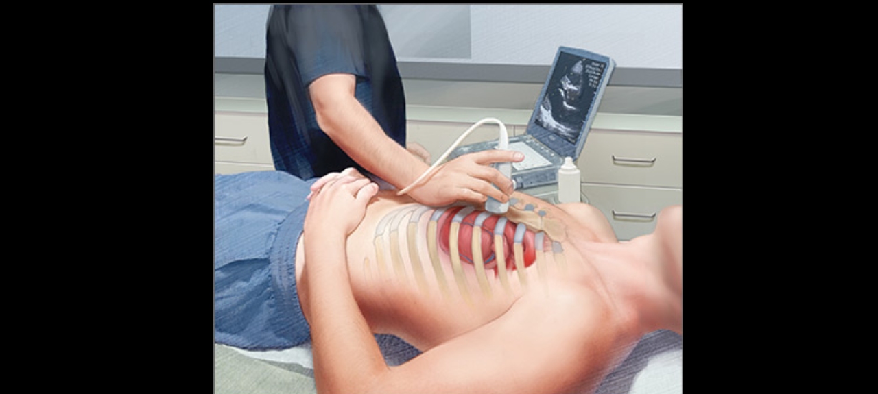 Curso de Ultrassonografia Point of Care em Emergência e UTI