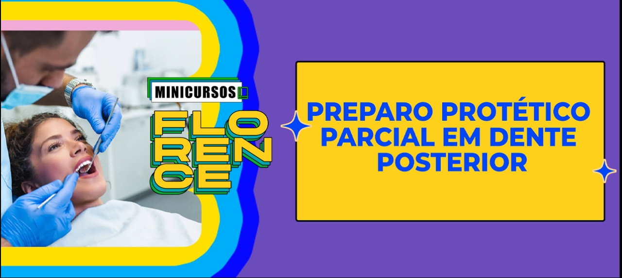 PREPARO PROTÉTICO PARCIAL EM DENTE POSTERIOR