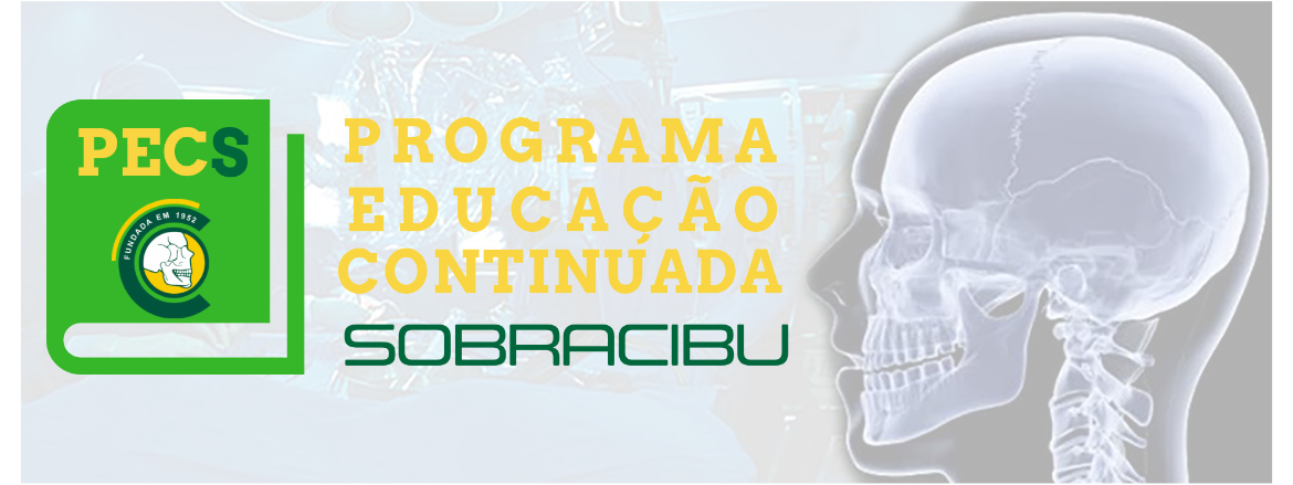 Evento